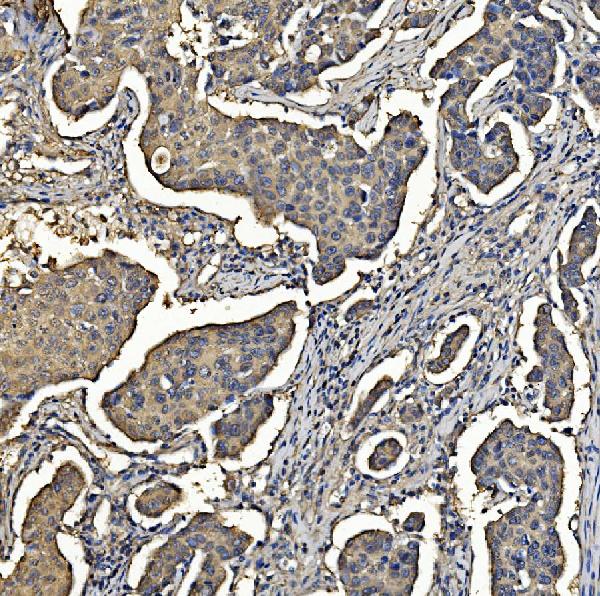2 - Anti-Aldolase/ALDOA Antibody Picoband™ (monoclonal, 6H8) ABO14982