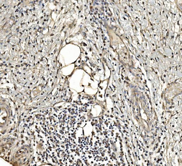2 - Anti-Aldolase/ALDOA Antibody Picoband™ (monoclonal, 6H8) ABO14982