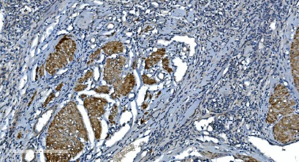 2 - Anti-Actin/ACTA1 Antibody Picoband™ (monoclonal, 3H5) ABO14983