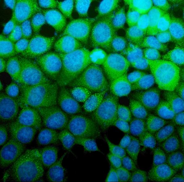 3 - Anti-ASS1 Antibody Picoband™ (monoclonal, 5I5) ABO14984