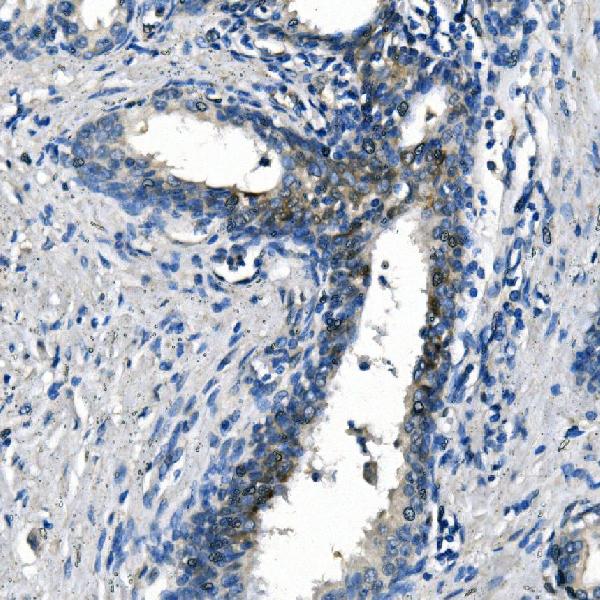 2 - Anti-ASS1 Antibody Picoband™ (monoclonal, 5I5) ABO14984