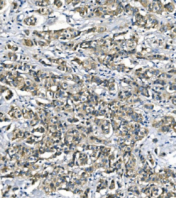 2 - Anti-ASS1 Antibody Picoband™ (monoclonal, 5I5) ABO14984