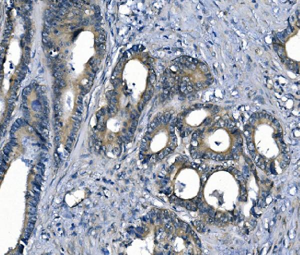 2 - Anti-ASS1 Antibody Picoband™ (monoclonal, 5I5) ABO14984