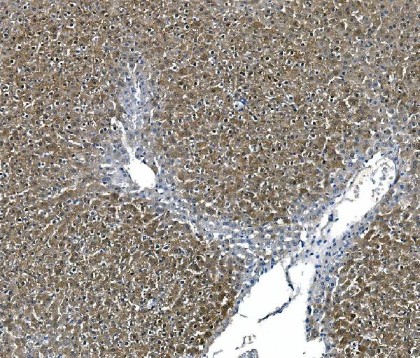 2 - Anti-ASS1 Antibody Picoband™ (monoclonal, 5I5) ABO14984