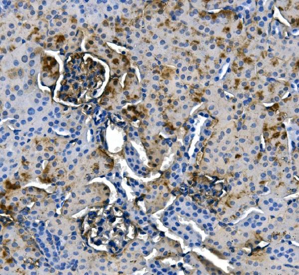 2 - Anti-ASS1 Antibody Picoband™ (monoclonal, 5I5) ABO14984