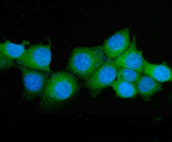 3 - Anti-ASS1 Antibody Picoband™ (monoclonal, 7I9) ABO14985