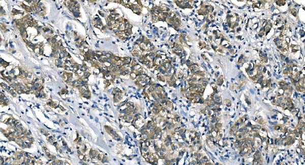 2 - Anti-ASS1 Antibody Picoband™ (monoclonal, 7I9) ABO14985
