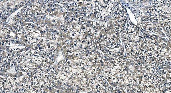 2 - Anti-ASS1 Antibody Picoband™ (monoclonal, 7I9) ABO14985