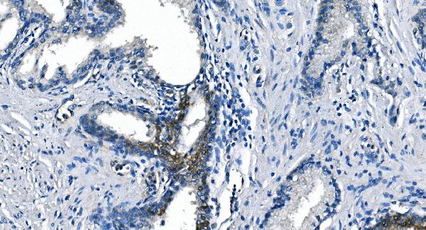 2 - Anti-ASS1 Antibody Picoband™ (monoclonal, 7I9) ABO14985