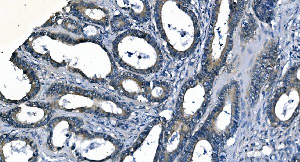 2 - Anti-ASS1 Antibody Picoband™ (monoclonal, 7I9) ABO14985