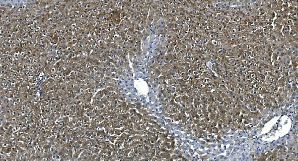 2 - Anti-ASS1 Antibody Picoband™ (monoclonal, 7I9) ABO14985