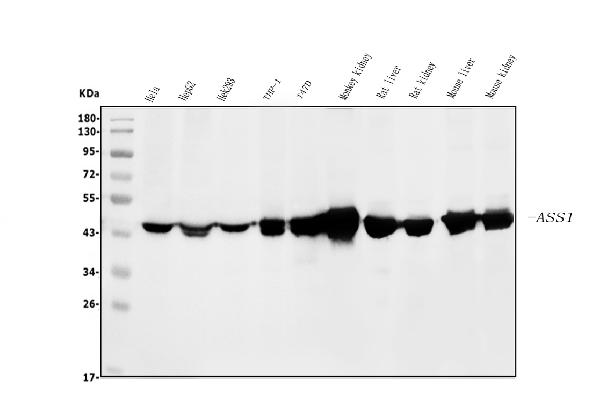 1 - Anti-ASS1 Antibody Picoband™ (monoclonal, 7I9) ABO14985