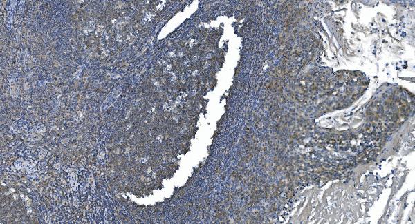 2 - Anti-eRF1/ETF1 Antibody Picoband™ (monoclonal, 3B6) ABO14986