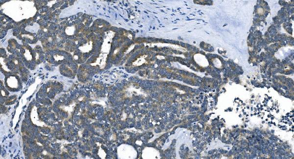 2 - Anti-eRF1/ETF1 Antibody Picoband™ (monoclonal, 3B6) ABO14986