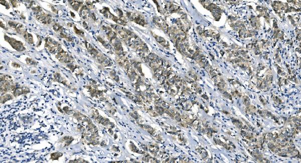 2 - Anti-eRF1/ETF1 Antibody Picoband™ (monoclonal, 3B6) ABO14986