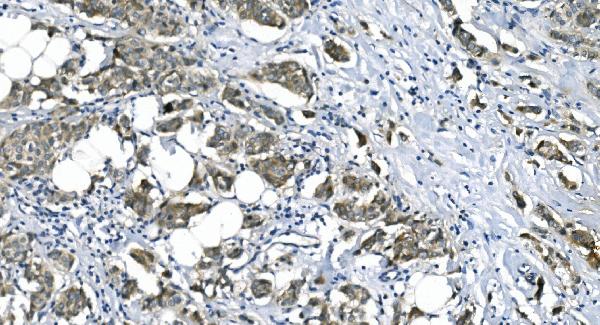 2 - Anti-eRF1/ETF1 Antibody Picoband™ (monoclonal, 3B6) ABO14986