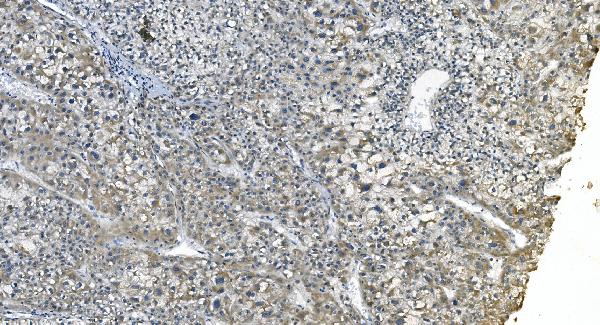 2 - Anti-eRF1/ETF1 Antibody Picoband™ (monoclonal, 3B6) ABO14986