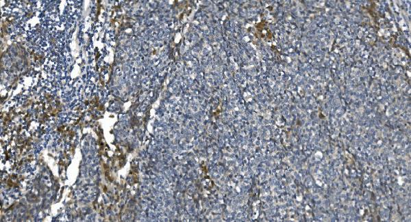 2 - Anti-eRF1/ETF1 Antibody Picoband™ (monoclonal, 3B6) ABO14986