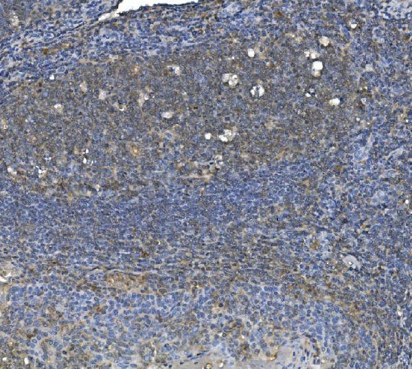 2 - Anti-eRF1/ETF1 Antibody Picoband™ (monoclonal, 3E5) ABO14987