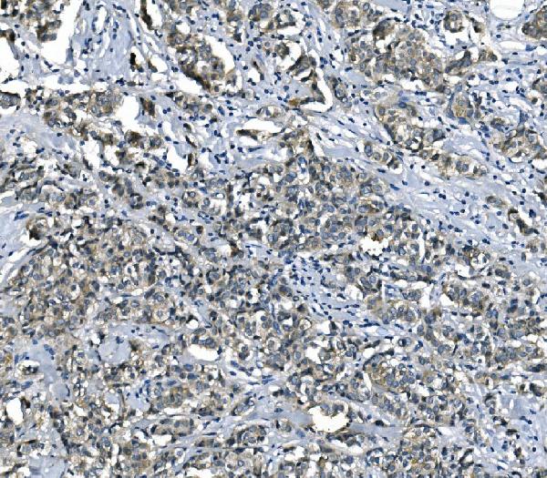 2 - Anti-eRF1/ETF1 Antibody Picoband™ (monoclonal, 3E5) ABO14987