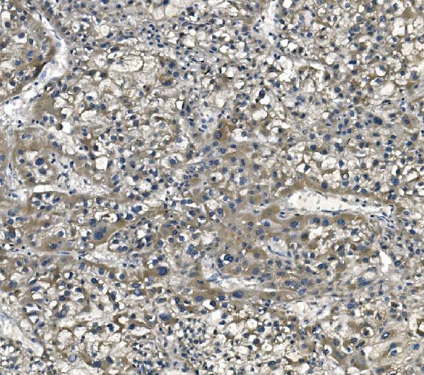2 - Anti-eRF1/ETF1 Antibody Picoband™ (monoclonal, 3E5) ABO14987