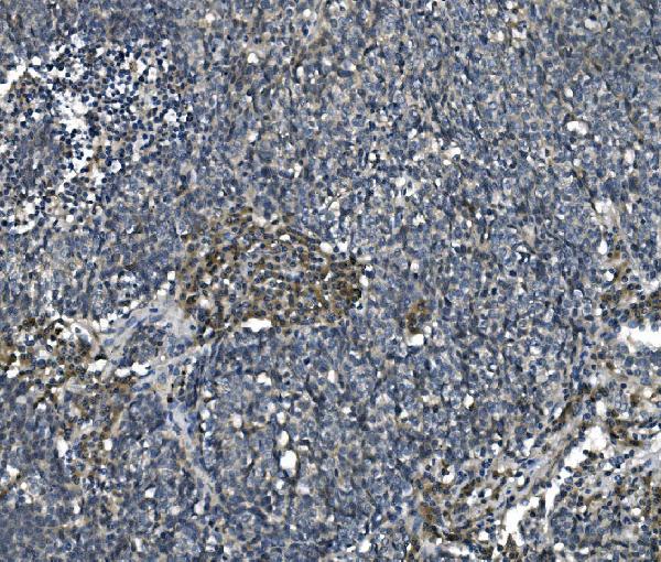 2 - Anti-eRF1/ETF1 Antibody Picoband™ (monoclonal, 3E5) ABO14987