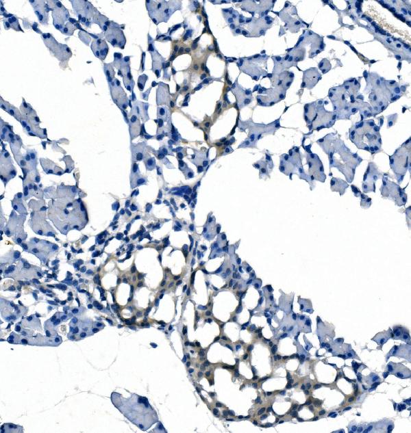 2 - Anti-eRF1/ETF1 Antibody Picoband™ (monoclonal, 3E5) ABO14987