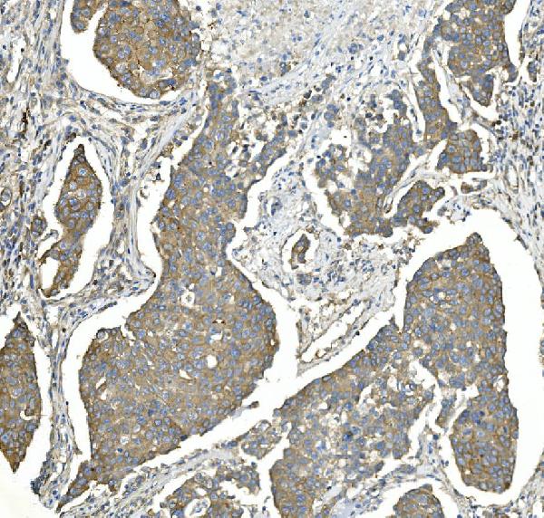 2 - Anti-EEF2 Picoband™ Antibody (monoclonal, 5F5) ABO14989