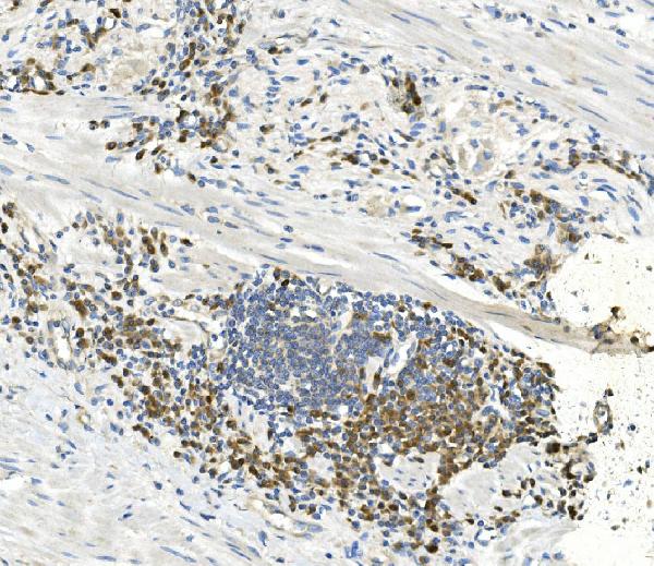 2 - Anti-EEF2 Picoband™ Antibody (monoclonal, 5F5) ABO14989
