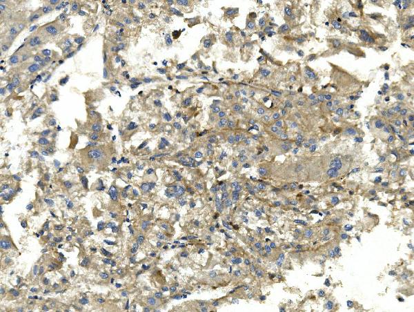 2 - Anti-EEF2 Picoband™ Antibody (monoclonal, 5F5) ABO14989