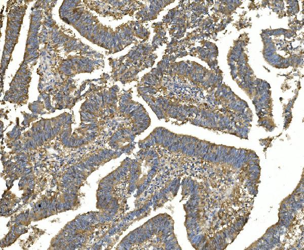 2 - Anti-EEF2 Picoband™ Antibody (monoclonal, 5F5) ABO14989