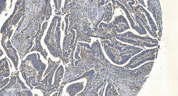 2 - Anti-APPL/APPL1 Antibody Picoband™ (monoclonal, 5G11) ABO14990