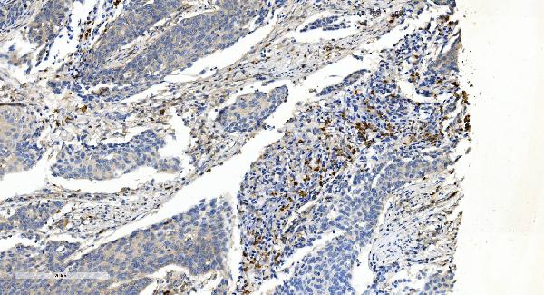 2 - Anti-APPL/APPL1 Antibody Picoband™ (monoclonal, 5G11) ABO14990