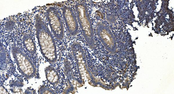 2 - Anti-APPL/APPL1 Antibody Picoband™ (monoclonal, 5G11) ABO14990