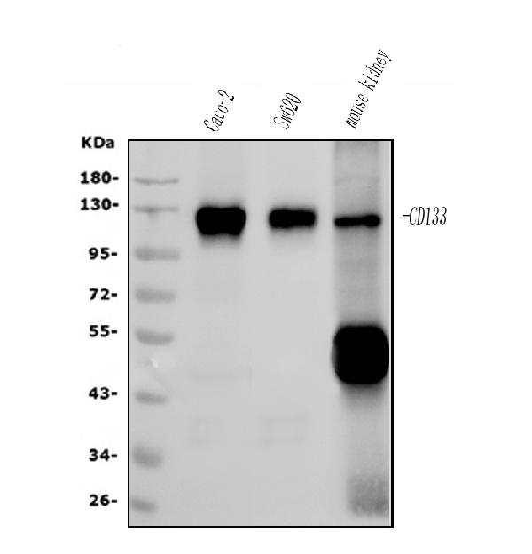 1 - Anti-PROM1/CD133 Antibody Picoband™ (monoclonal, 8B6) ABO14991