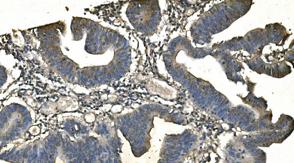 2 - Anti-CD13/ANPEP Picoband™ Antibody (monoclonal, 5B9) ABO14993