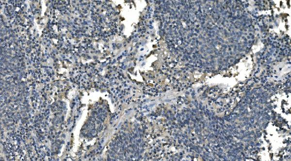 2 - Anti-CD13/ANPEP Picoband™ Antibody (monoclonal, 5B9) ABO14993