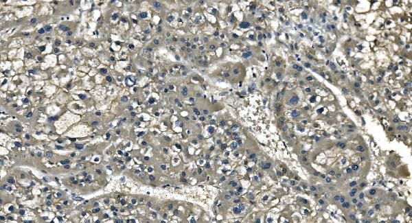 2 - Anti-CD13/ANPEP Picoband™ Antibody (monoclonal, 5B9) ABO14993