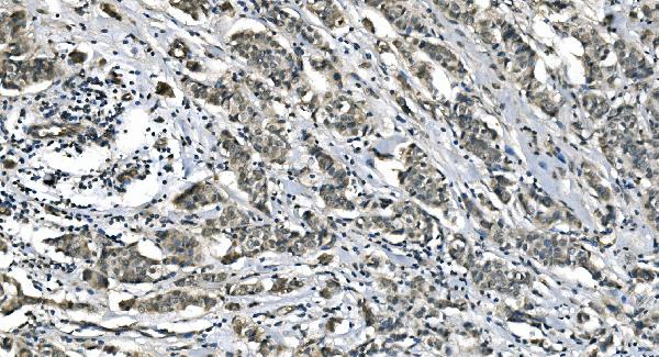 2 - Anti-Carbonic Anhydrase I/CA1 Picoband™ Antibody (monoclonal, 4D5) ABO14994