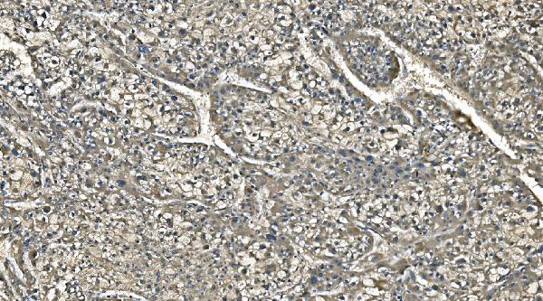 2 - Anti-Carbonic Anhydrase I/CA1 Picoband™ Antibody (monoclonal, 4D5) ABO14994