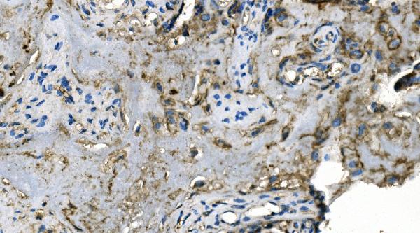 2 - Anti-Carbonic Anhydrase I/CA1 Picoband™ Antibody (monoclonal, 4D5) ABO14994