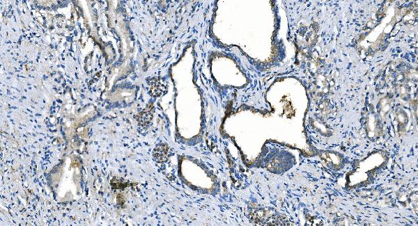 2 - Anti-Carbonic Anhydrase I/CA1 Picoband™ Antibody (monoclonal, 4D5) ABO14994