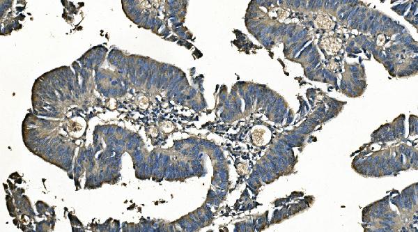 2 - Anti-Carbonic Anhydrase I/CA1 Picoband™ Antibody (monoclonal, 4D5) ABO14994
