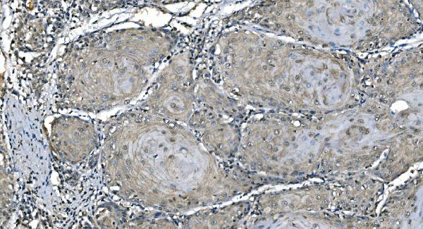 2 - Anti-Carbonic Anhydrase I/CA1 Picoband™ Antibody (monoclonal, 4D5) ABO14994