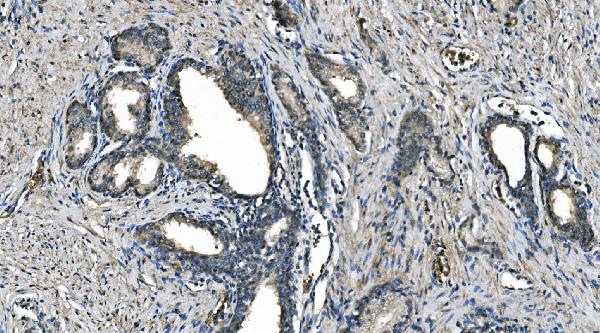 2 - Anti-Carbonic Anhydrase I/CA1 Picoband™ Antibody (monoclonal, 4D5) ABO14994