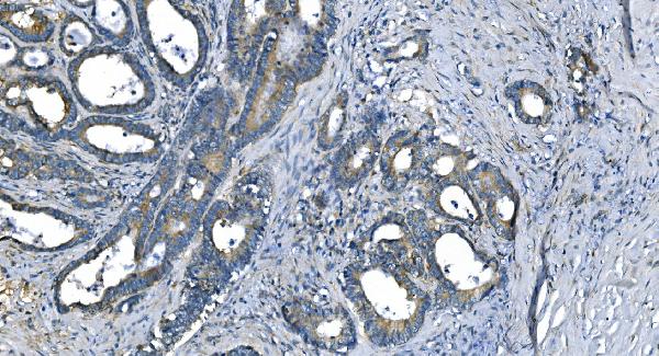 2 - Anti-Carbonic Anhydrase I/CA1 Picoband™ Antibody (monoclonal, 2B5) ABO14995