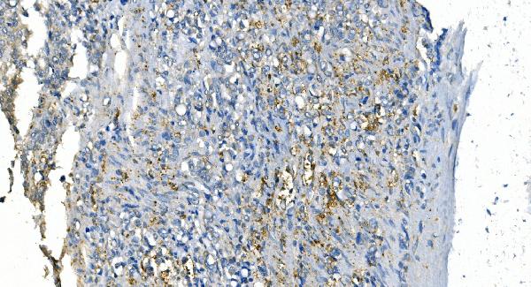 2 - Anti-Carbonic Anhydrase I/CA1 Picoband™ Antibody (monoclonal, 2B5) ABO14995
