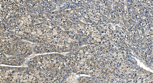 2 - Anti-Carbonic Anhydrase I/CA1 Picoband™ Antibody (monoclonal, 2B5) ABO14995