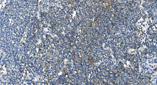 2 - Anti-Carbonic Anhydrase I/CA1 Picoband™ Antibody (monoclonal, 2B5) ABO14995