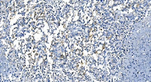 2 - Anti-Carbonic Anhydrase I/CA1 Picoband™ Antibody (monoclonal, 2B5) ABO14995